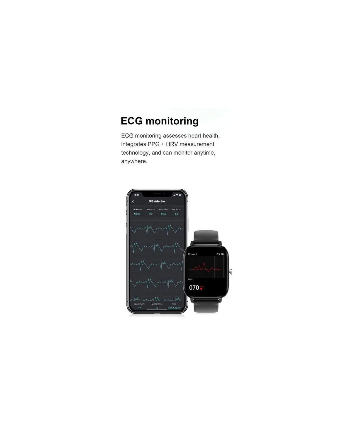 SMARTWATCH UNISEX PACIFIC 20-9 - EKG, WYKONYWANIE POŁĄCZEŃ (sy017h) SMARTWATCH UNISEX PACIFIC 20-9 - EKG, WYKONYWANIE POŁĄCZEŃ (sy017h)