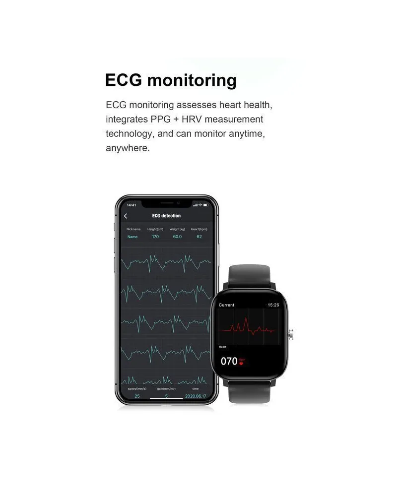 SMARTWATCH UNISEX PACIFIC 20-9 - EKG, WYKONYWANIE POŁĄCZEŃ (sy017h) SMARTWATCH UNISEX PACIFIC 20-9 - EKG, WYKONYWANIE POŁĄCZEŃ (sy017h)